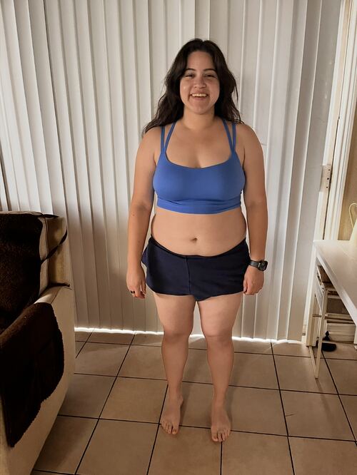 Arlene before